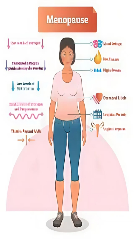 menopause